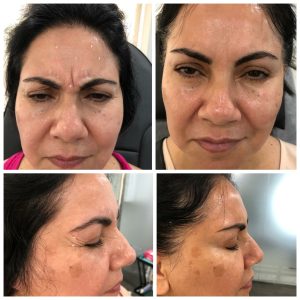 Anti Ageing