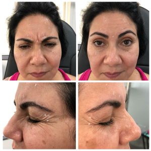 antiageing