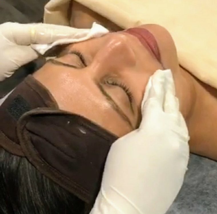 medifacial (1)